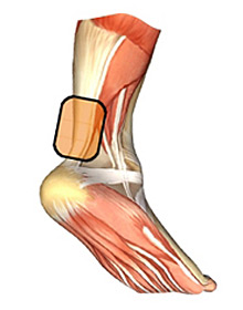 expert_achilles